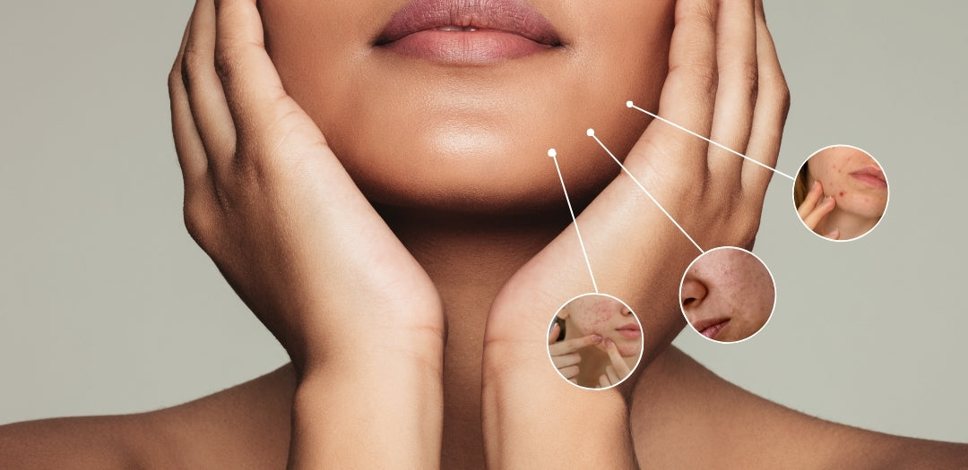 Causes of skin barrier damage and how to prevent it